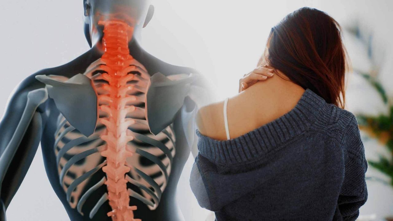 Boyun Fıtığına Son Boyun Fıtığı Tarih Oluyor İşte Boyun Fıtığını Bitirmenin En İyi Yolu Nedir